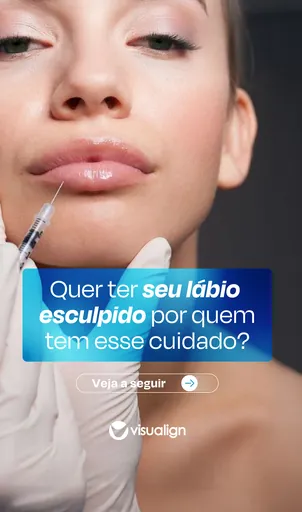 Story da Visualign sobre preenchimento labial